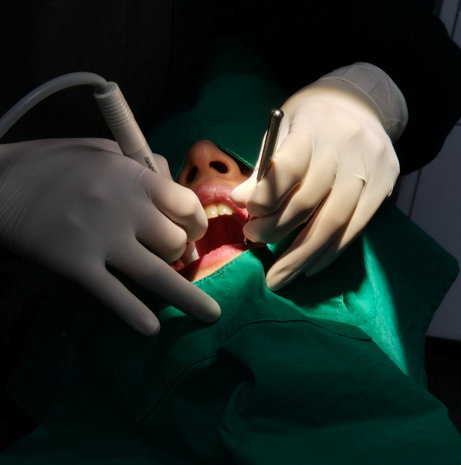 앞니충치치료, 2가지만 확인하면 됩니다 관련 이미지 7