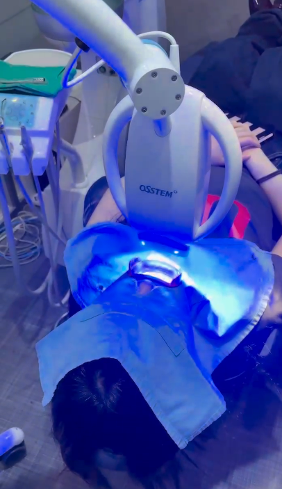 라미네이트 레진, 덤탱이를 피하려면 꼭 보세요 관련 이미지 7