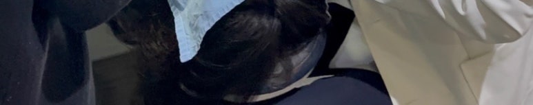 치은퇴축, 의사가 직접 알려드리는 2가지 진실 관련 이미지 14