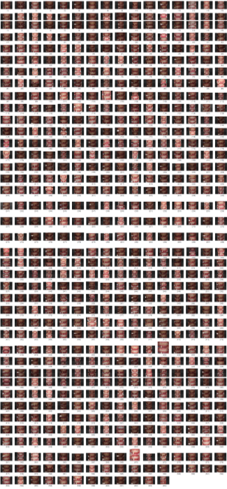치과치아미백? 연예인처럼 새하얀 치아 못 만듭니다. 관련 이미지 1