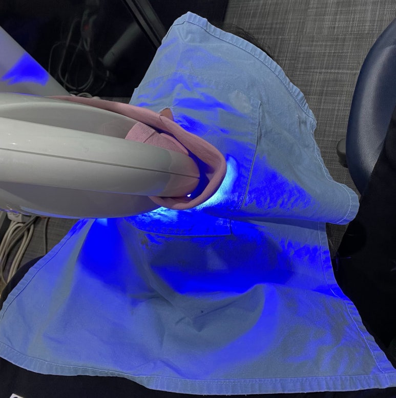 치과치아미백? 연예인처럼 새하얀 치아 못 만듭니다. 관련 이미지 2