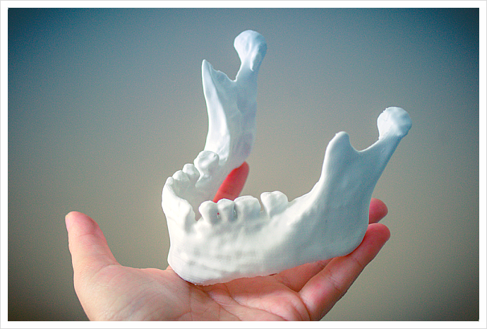 강남 임플란트 치과 추천, 저렴한 곳 가도될까? 관련 이미지 2