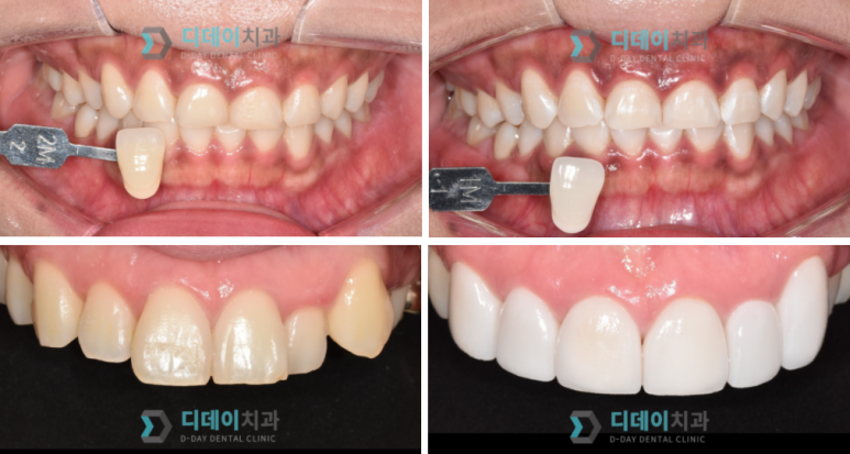 학동역/언주역 치과? 실력있는 치과 찾는 TIP 관련 이미지 1