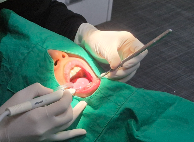 한티역치과? 의사가 알려주는 임플란트 선택 기준 단 2가지 관련 이미지 7