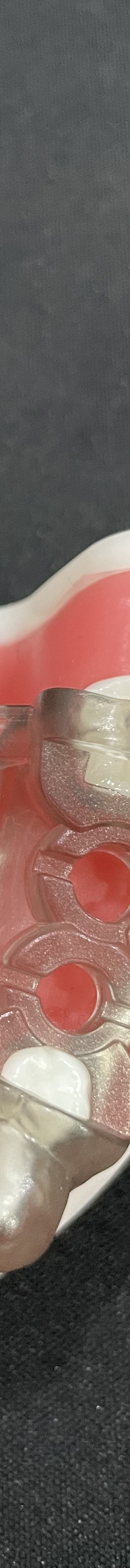 강남역 치과 임플란트 수면마취?해야만 하는 경우 관련 이미지 13