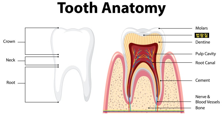 치아반점(반상치, 반점치) 혹시 문제있는건 아닌지 걱정된다면? 관련 이미지 2