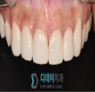 매봉역치과? "양심 치과" 찾는 법 공개합니다. 관련 이미지 2