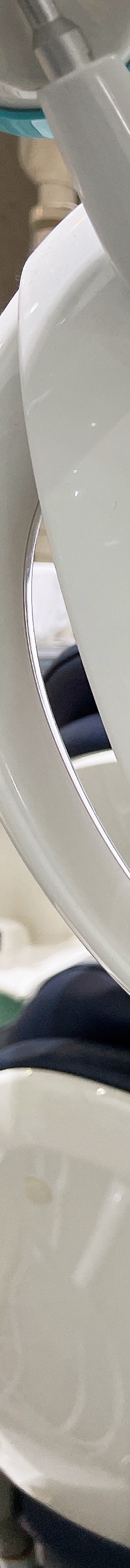 원데이 치과미백 치료? 5000건 해보고 알려드립니다. 관련 이미지 9