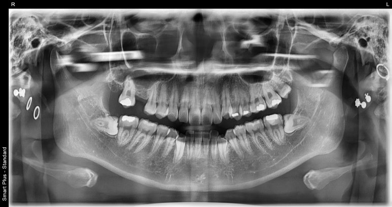 역삼동치과, 과잉진료 무서워서 치과 안가는 일 없게 해드립니다. 관련 이미지 5