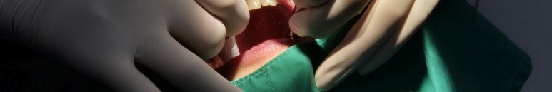 앞니뿌리충치, 치료과정 정리해드립니다. 관련 이미지 10