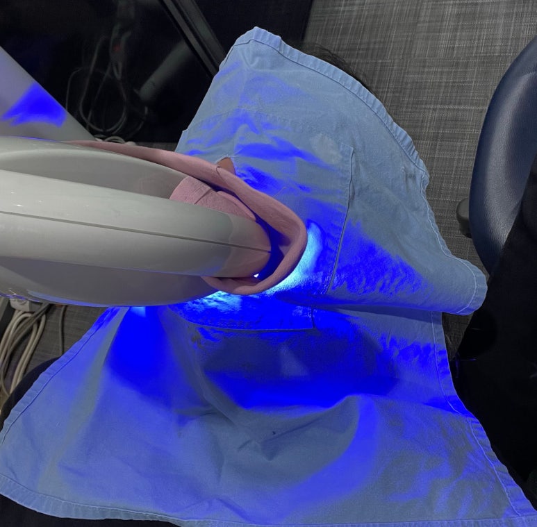 치과치아미백 #내돈내산 찐후기 (feat. 직원이 직접 받은 솔직후기) 관련 이미지 1