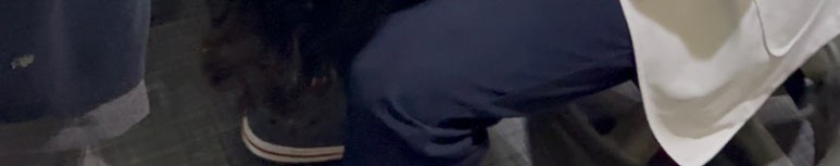 치은퇴축, 의사가 직접 알려드리는 2가지 진실 관련 이미지 15