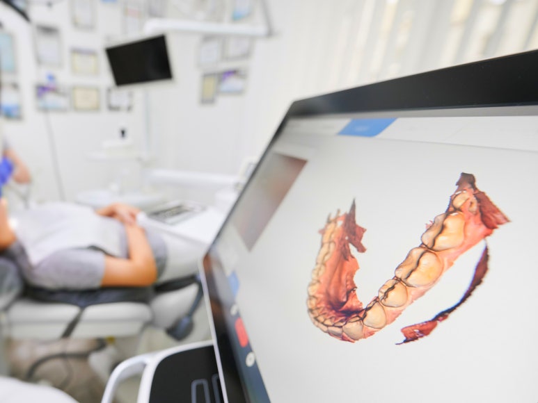 3D임플란트, 네비게이션 비용/통증/과정 총정리 관련 이미지 5