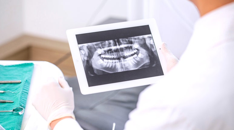 임플란트 교체시기를 늦추는, 치료보다 중요한 관련 이미지 5