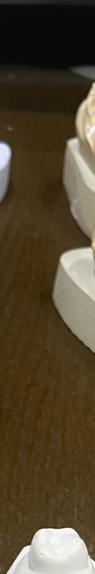 매봉역 치과, 자연치아 잃고 싶지 않다면? 관련 이미지 12