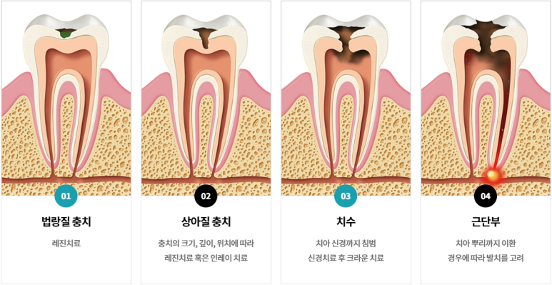 서울안아픈치과? 이제 치과 무서워하지 마세요 관련 이미지 4