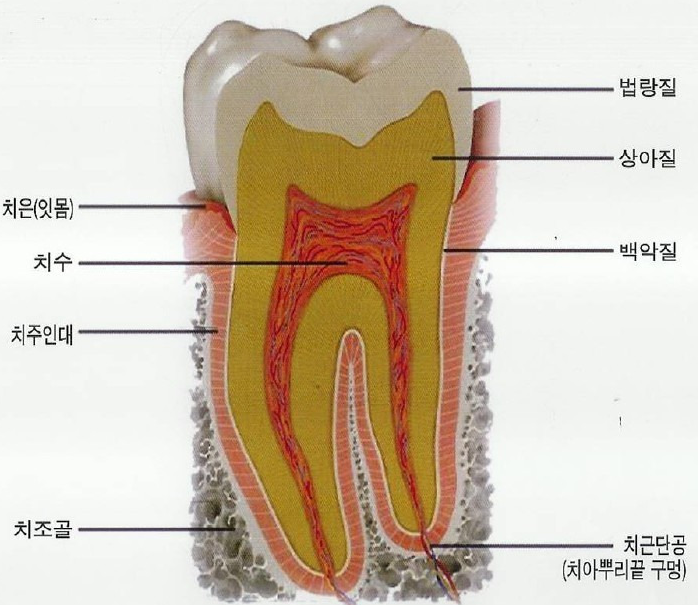 치아검은점, 충치일 확률 90%라는 것은 거짓입니다 관련 이미지 4