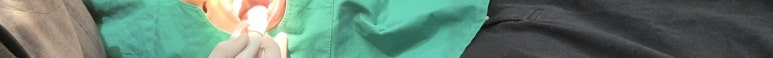도곡역치과 치아미백, 치료 전 반드시 알아야 할 2가지 관련 이미지 14