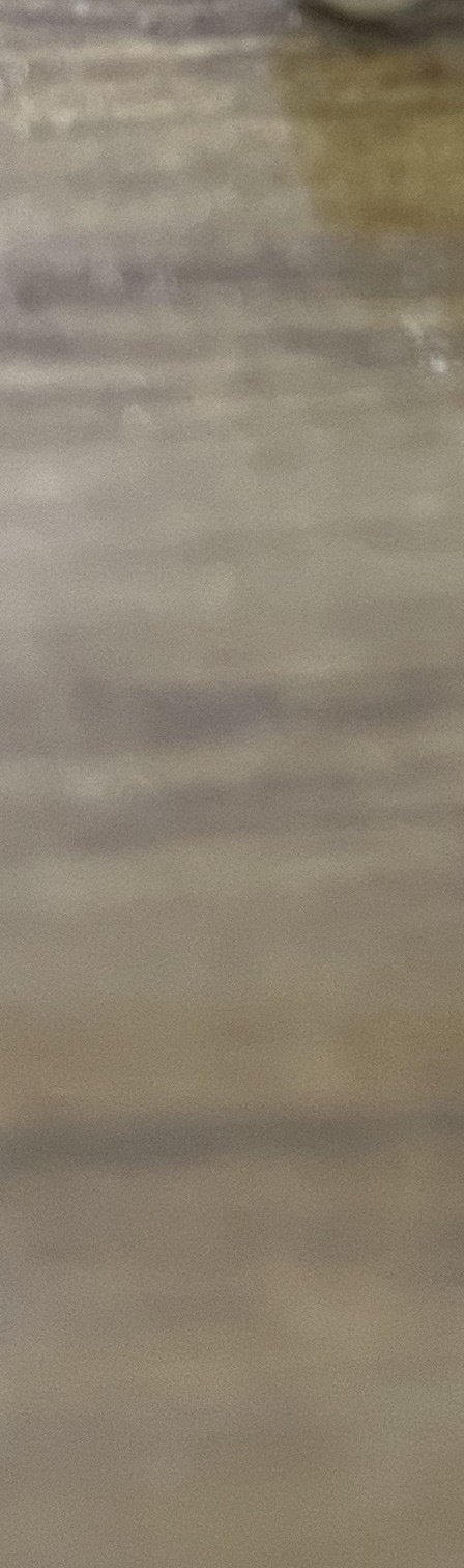 서초동 치과, 통증이 두려워 방문을 꺼리신다면? 관련 이미지 15