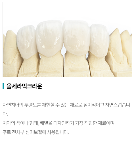 치아크라운비용은 얼마인지, 꼭 해야하는지 궁금하다면? 관련 이미지 6