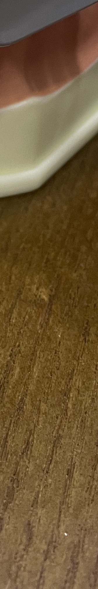 양재역 치과, 실력과 양심 두마리 토끼를 놓치지 않는 방법 관련 이미지 24