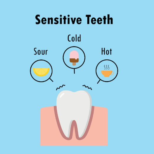 치아미백 횟수? 병원? 시술 전 알면 좋은 체크리스트 관련 이미지 3