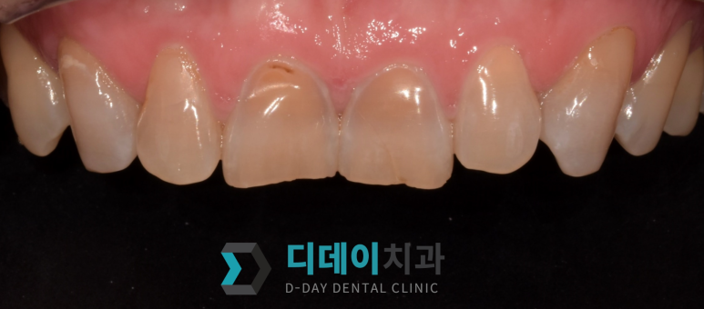 라미네이트종류, 이것만 확인하면 됩니다 관련 이미지 3