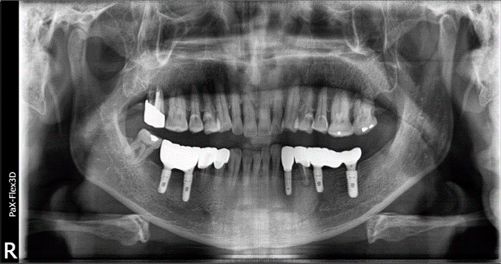 선릉치과? 치료받기 전에 꼭 알아야 할 것 관련 이미지 6
