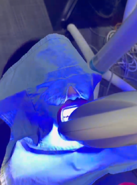 선릉역치아미백 리뷰 보기 전에 관련 이미지 4