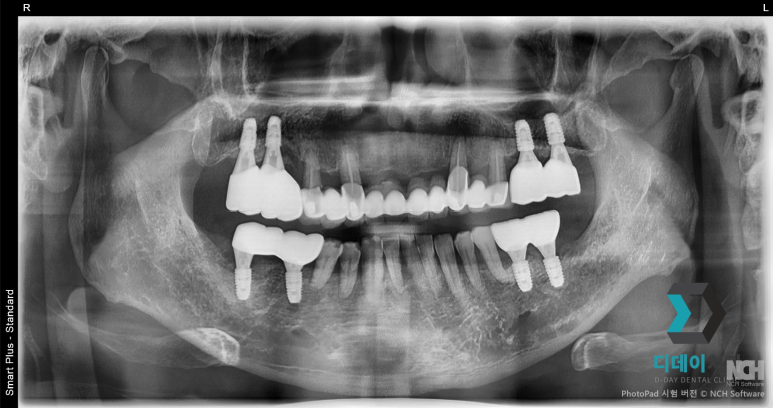 Looking for a recommended dental clinic near Seolleung Station? You only need to know 2 things image 4