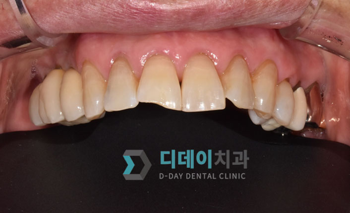 선정릉역 치과, 여전히 관련 이미지 1
