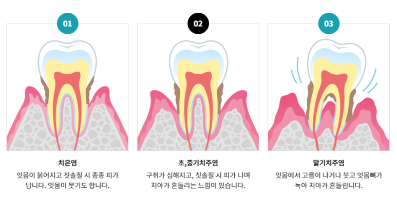 근로자의날, 5월 대체공휴일 진료하는 치과를 찾으려면? 관련 이미지 6