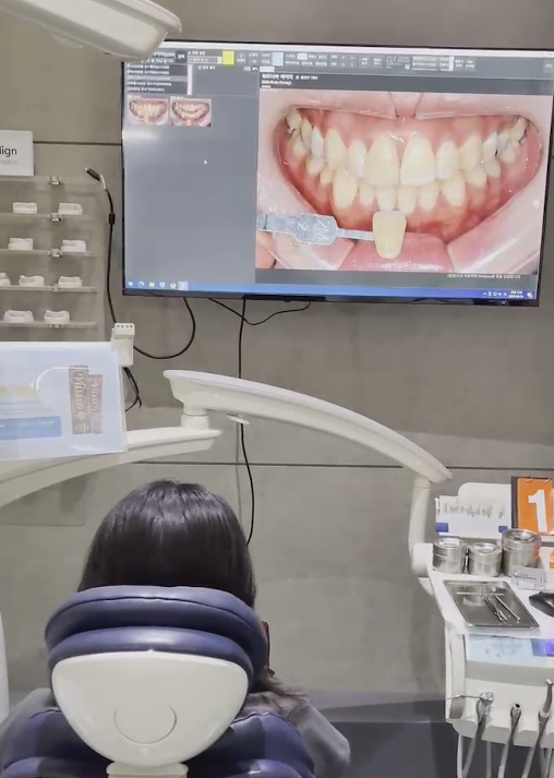 치아미백치료가격만 보고 가면 안되는 이유 2가지 관련 이미지 3