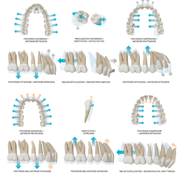 강남역치아교정, 관련 이미지 3