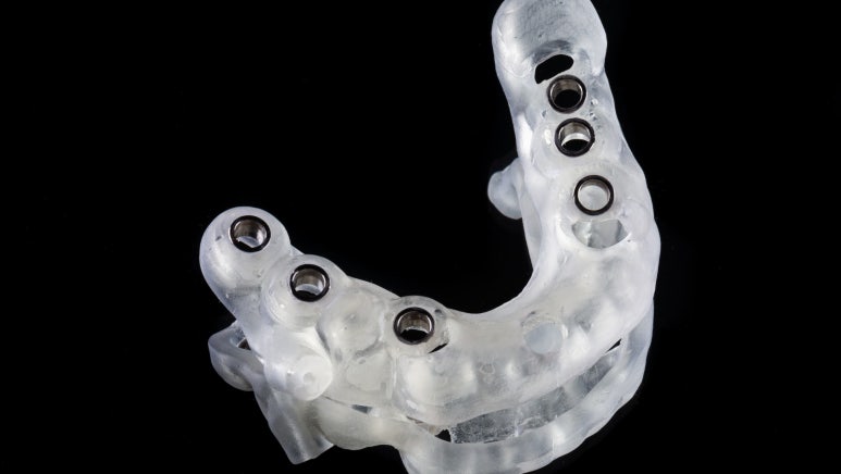 3D임플란트, 네비게이션 비용/통증/과정 총정리 관련 이미지 6