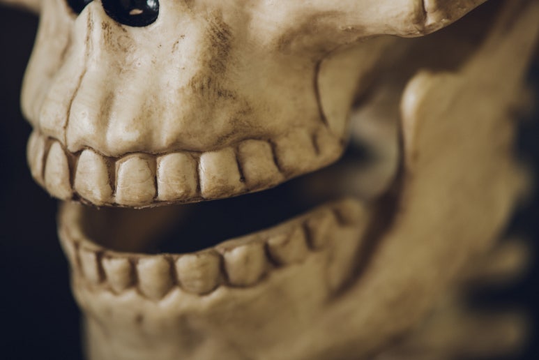 내몸에 들어갈 임플란트뼈이식 재료와 비용, 제대로 알고 계신가요? 관련 이미지 4