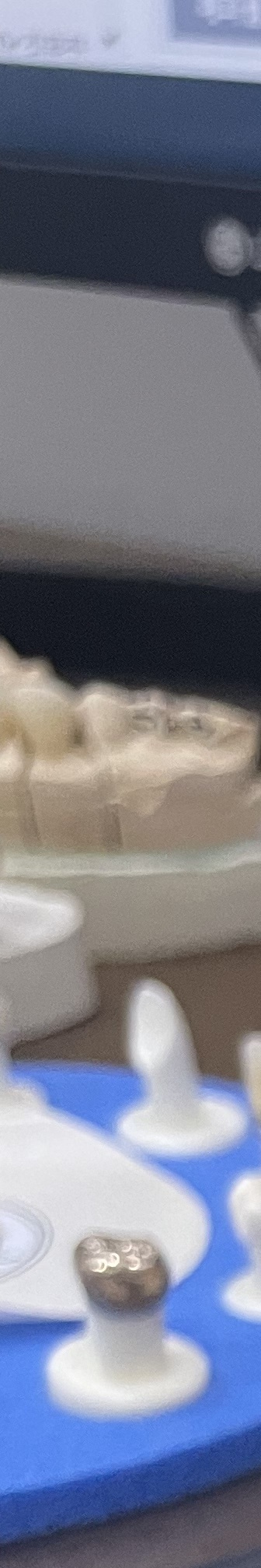 양재역 치과, 실력과 양심 두마리 토끼를 놓치지 않는 방법 관련 이미지 10