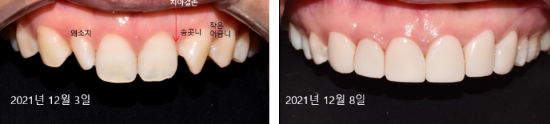 강남구청역치과? 못 찾습니다. 관련 이미지 1