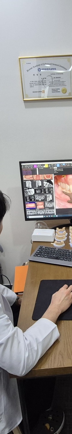 대치동 레진과 인레이 치료 어떤 경우에 사용할까 관련 이미지 11