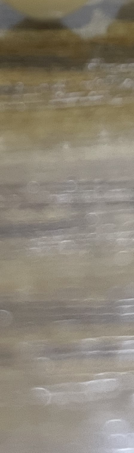 서초동 치과, 통증이 두려워 방문을 꺼리신다면? 관련 이미지 17