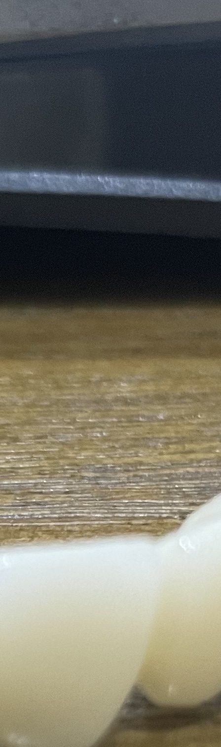 서초동 치과, 통증이 두려워 방문을 꺼리신다면? 관련 이미지 9