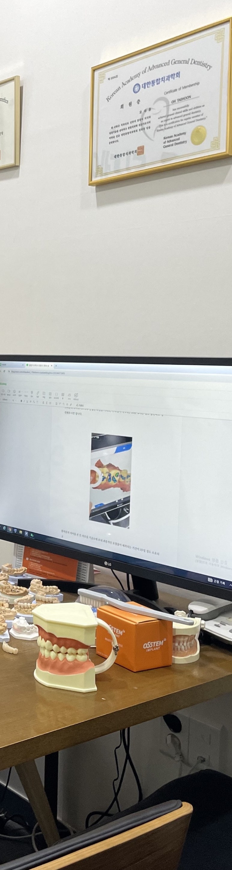 역삼동 신경치료 치과, 과정부터 실비적용 전격 공개 관련 이미지 7