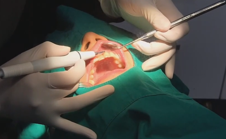 개포동치과, 충치치료 아픈가요? A to Z 알려드립니다 관련 이미지 7