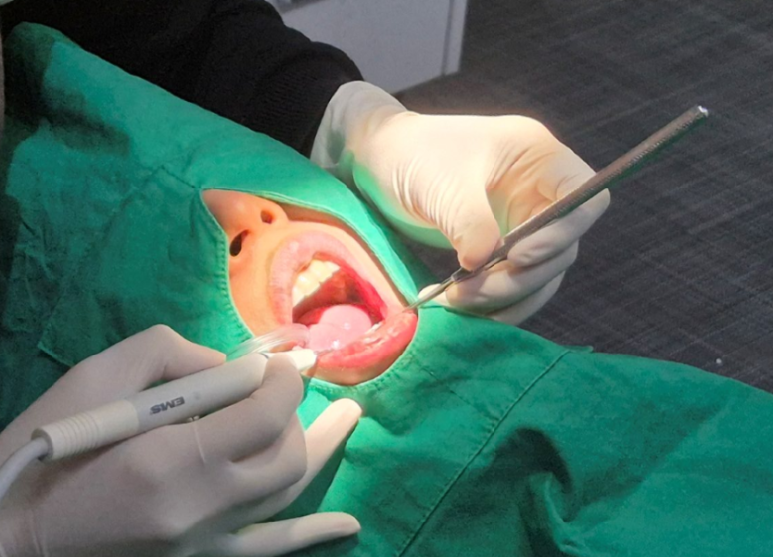 치은성형술, 잇몸이 너무 많이 보여서 웃기 싫었다면 의사 작성 관련 이미지 8