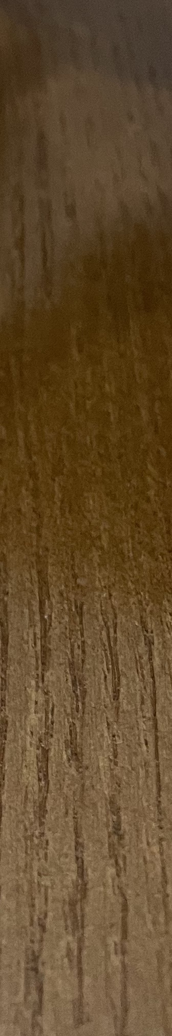 양재역 치과, 실력과 양심 두마리 토끼를 놓치지 않는 방법 관련 이미지 27