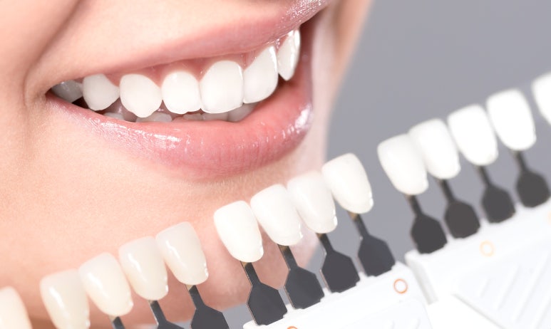 라미네이트색상, 모양 후회 안하려면? 관련 이미지 1