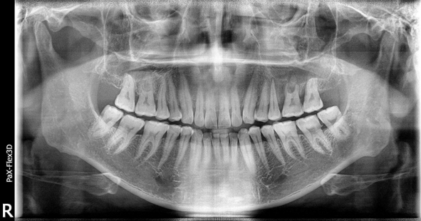 강남치과추천? 내게 꼭 맞는 치과 고르는 방법 관련 이미지 5