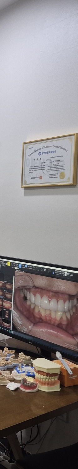 삼성동치과 치아미백 선택할 때 관련 이미지 15