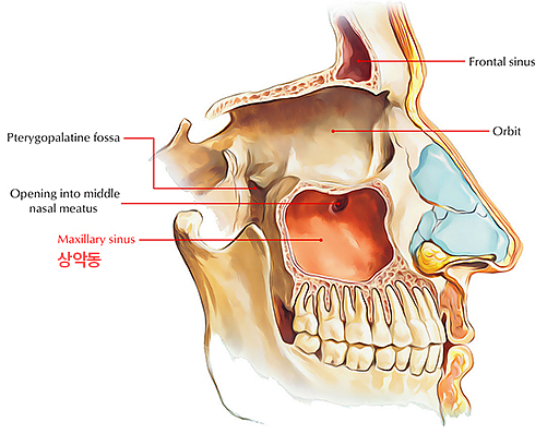 상악동거상술비용, 투명하게 공개합니다 관련 이미지 2