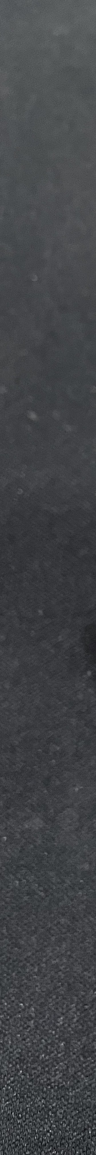 강남역 치과 임플란트 수면마취?해야만 하는 경우 관련 이미지 7